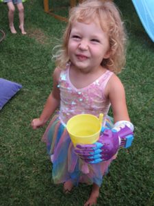 Girl with prosthetic hand