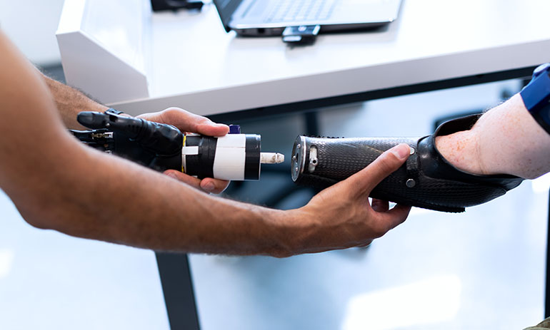 Close up photo of a person having a prosthetic arm fitted, supported by another person.