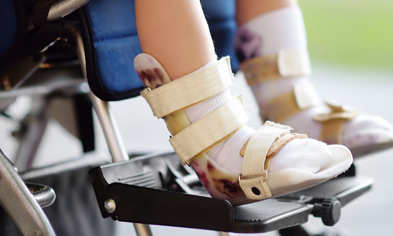 close up of girl wearing ankle brace