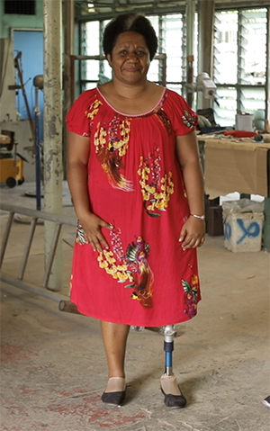 Woman with prosthetic leg wearing red dress standing in workshop